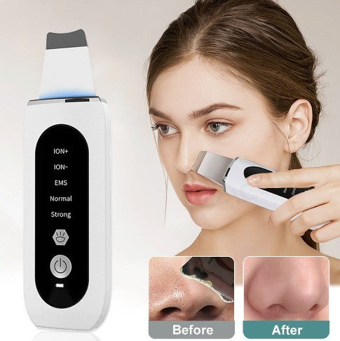 🌸 Shovel Skin Blackhead Ultrasonic Beauty Device