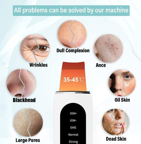 🌸 Shovel Skin Blackhead Ultrasonic Beauty Device